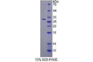 SDS-PAGE (SDS) image for Triadin (TRDN) (AA 486-687) protein (His tag) (ABIN4989694) (Triadin Protein (TRDN) (AA 486-687) (His tag))