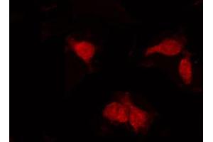 ABIN6268908 staining COS7 by IF/ICC. (Aurora Kinase B antibody)