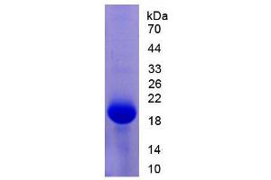 SDS-PAGE analysis of Mouse Pim-1 Oncogene Protein. (PIM1 Protein)