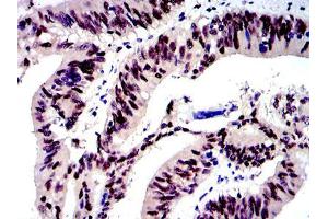 Immunohistochemistry (IHC) image for anti-Jun Proto-Oncogene (JUN) antibody (ABIN968994)