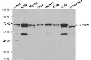 Western blot analysis of extracts of various cell lines, using IGF2BP1 antibody (ABIN6293020) at 1:1000 dilution. (IGF2BP1 antibody)