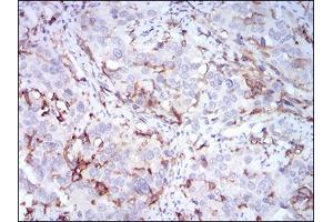 Immunohistochemistry (IHC) image for anti-CD14 (CD14) (AA 20-214) antibody (ABIN1724922)