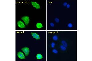 ABIN6391415 Immunofluorescence analysis of paraformaldehyde fixed MCF7 cells, permeabilized with 0. (TBC1D10A antibody  (N-Term))