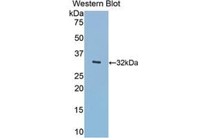 Detection of Recombinant Hpt,Hu using Polyclonal Antibody to Meningioma Expressed Antigen 5 (MGEA5) (MGEA5 antibody  (AA 319-450))