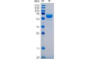 Human SIG Protein, mFc-His Tag on SDS-PAGE under reducing condition. (SIGLEC15 Protein (AA 20-263) (mFc-His Tag))