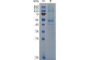 IFNB1 Protein (AA 22-187) (Fc Tag)