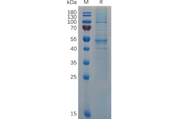 IFNB1 Protein (AA 22-187) (Fc Tag)