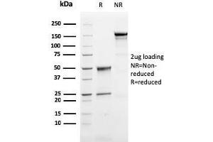 SDS-PAGE Analysis of Purified Perforin-1 Mouse Monoclonal Antibody (PRF1/2468). (Perforin 1 antibody  (AA 413-552))