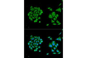 Immunofluorescence analysis of MCF-7 cells using DDX58 antibody. (DDX58 antibody)