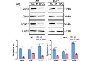 Downregulation of SKA3 affects the cell cycle in HCC cells. (SKA3 antibody  (AA 201-300))