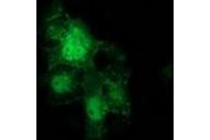 Anti-CTNNB1 mouse monoclonal antibody (ABIN2454135) immunofluorescent staining of COS7 cells transiently transfected by pCMV6-ENTRY CTNNB1 (RC208947). (CTNNB1 antibody)
