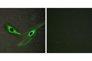 Peptide - +Immunohistochemistry analysis of paraffin-embedded human brain tissue, using ICK antibody. (ICK antibody)