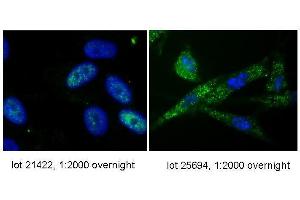anti-hTERT antibody-Immunofluorescence. (hTERT (C-Term) antibody)