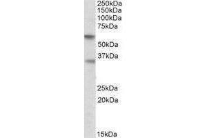Western Blotting (WB) image for anti-Sialic Acid Binding Ig-Like Lectin 6 (SIGLEC6) (AA 126-136) antibody (ABIN793157) (SIGLEC6 antibody  (AA 126-136))