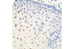 Immunohistochemistry of paraffin-embedded human esophagus using HNRNPA0 antibody. (HNRNPA0 antibody  (AA 1-180))