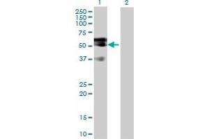 Western Blot analysis of LIPG expression in transfected 293T cell line by LIPG MaxPab polyclonal antibody. (LIPG antibody  (AA 1-500))