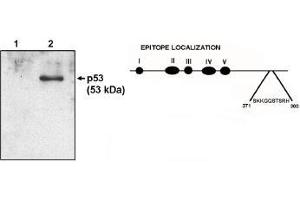 Image no. 1 for anti-Tumor Protein P53 (TP53) (AA 371-380) antibody (ABIN201677) (p53 antibody  (AA 371-380))