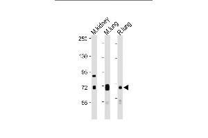 All lanes : Anti-DLL4 Antibody (C-Term) at 1:1000-1:2000 dilution Lane 1: Mouse kidney lysate Lane 2: Mouse lung lysate Lane 3: Rat lung lysate Lysates/proteins at 20 μg per lane. (DLL4 antibody  (AA 608-641))