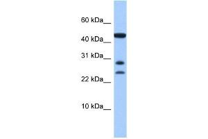 C20ORF141 antibody used at 1 ug/ml to detect target protein. (C20orf141 antibody  (Middle Region))