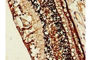 Immunohistochemistry of paraffin-embedded human eye tissue using ABIN7167780 at dilution of 1:100 (RLBP1 antibody  (AA 10-91))