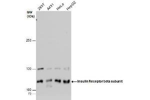 WB Image Insulin Receptor beta subunit antibody detects Insulin Receptor beta subunit protein by western blot analysis. (Insulin Receptor antibody  (C-Term))