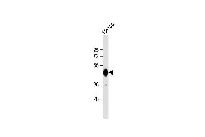 Anti-HIS Tag Antibody at 1:2000 dilution + 12-tag protein lysate Lysates/proteins at 20 μg per lane. (His Tag antibody)