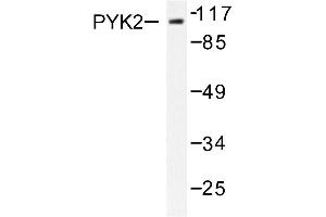 Image no. 1 for anti-PTK2B Protein tyrosine Kinase 2 beta (PTK2B) antibody (ABIN271907) (PTK2B antibody)