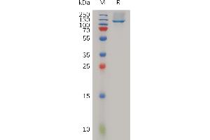 Human Protein, His Tag on SDS-PAGE under reducing condition. (Neuropilin 1 Protein (NRP1) (AA 22-856) (His tag))