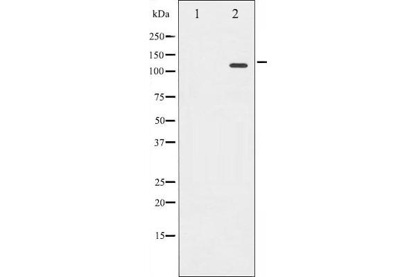 Retinoblastoma 1 antibody  (pSer780)