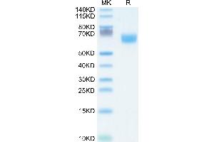 Human FGFR2 beta (IIIb) Domain on Tris-Bis PAGE under reduced condition. (FGFR2 beta (AA 253-378) protein (Fc Tag))