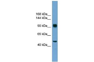 WB Suggested Anti-RB1 Antibody Titration: 0. (Retinoblastoma 1 antibody  (N-Term))