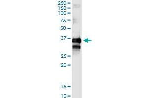 Immunoprecipitation of TTC1 transfected lysate using rabbit polyclonal anti-TTC1 and Protein A Magnetic Bead (TTC1 (Human) IP-WB Antibody Pair)