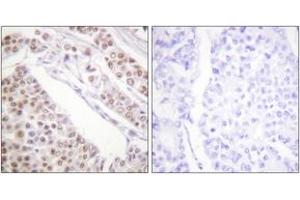 Immunohistochemistry (IHC) image for anti-Histone H2B (acLys12) antibody (ABIN2890727) (Histone H2B antibody  (acLys12))