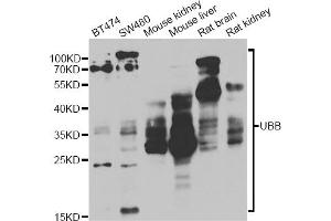 Western blot analysis of extracts of various cell lines, using UBB antibody (ABIN1875248) at 1:1000 dilution. (Ubiquitin B antibody)