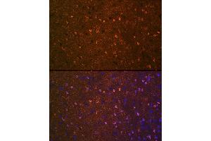 Immunofluorescence analysis of mouse brain using BDNF Rabbit mAb (ABIN7265916) at dilution of 1:100 (40x lens). (BDNF antibody)