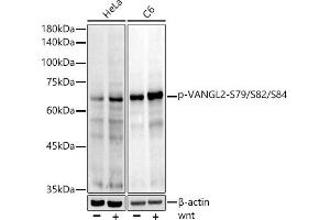 Western blot analysis of extracts of various cell lines, using Phospho-V-S79/S82/S84 Rabbit mAb antibody (ABIN7271290) at 1:1000 dilution. (VANGL2 antibody  (pSer79, pSer82, pSer84))