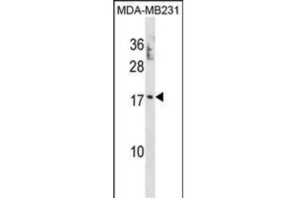PTRH2 antibody  (N-Term)
