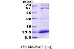 SDS-PAGE (SDS) image for Platelet Factor 4 (PF4) (AA 32-101) protein (His tag) (ABIN6387192) (PF4 Protein (AA 32-101) (His tag))