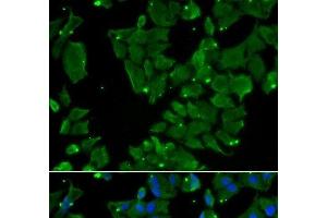 Immunofluorescence analysis of HeLa cells using DBN1 Polyclonal Antibody (DBN1 antibody)