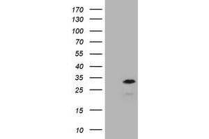 Image no. 1 for anti-Membrane-Spanning 4-Domains, Subfamily A, Member 1 (MS4A1) antibody (ABIN1497209) (CD20 antibody)