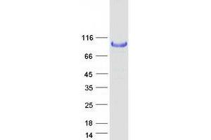 Validation with Western Blot (Hexokinase 1 Protein (HK1) (Transcript Variant 1) (Myc-DYKDDDDK Tag))