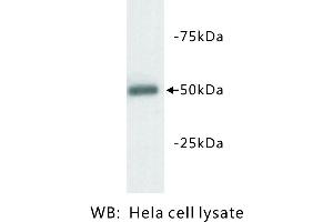 Image no. 1 for anti-Tubulin, beta 3 (TUBB3) antibody (ABIN1112942) (TUBB3 antibody)