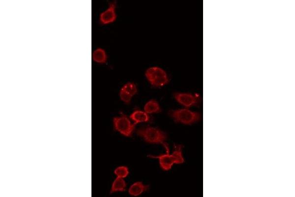 ZDHHC15 antibody  (C-Term)