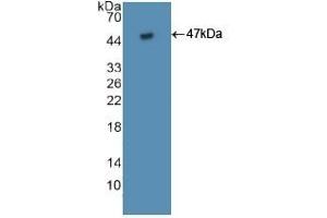 Detection of Recombinant FAS, Human using Polyclonal Antibody to Factor Related Apoptosis (FAS) (FAS antibody  (AA 22-172))