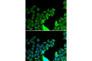 Immunofluorescence analysis of HeLa cells using BCL2L14 antibody. (BCL2L14 antibody)