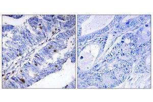 Immunohistochemistry (IHC) image for anti-Nuclear Receptor Subfamily 4, Group A, Member 1 (NR4A1) (pSer351) antibody (ABIN1847422) (NR4A1 antibody  (pSer351))