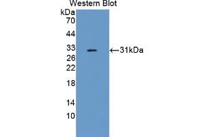 Figure. (Complement Factor I antibody  (AA 358-603))