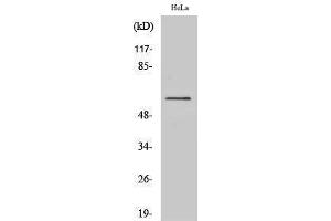 Western Blotting (WB) image for anti-B-Raf proto-oncogene, serine/threonine kinase (BRAF) (Internal Region) antibody (ABIN3180846) (BRAF antibody  (Internal Region))
