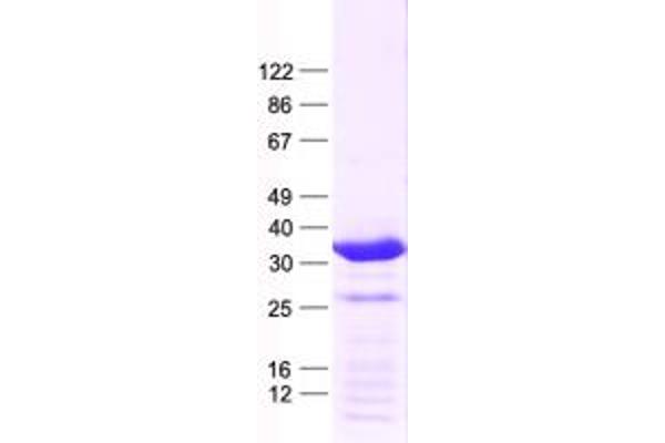 HMX2 Protein (His tag)