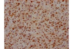 Immunohistochemistry (IHC) image for anti-Far Upstream Element (FUSE) Binding Protein 1 (FUBP1) antibody (ABIN7127503)